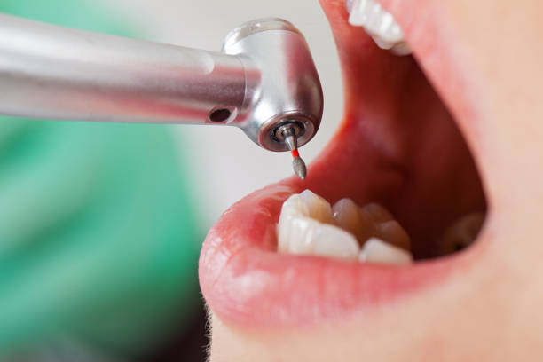 Best Emergency Cosmetic Dentistry in Terryville, CT